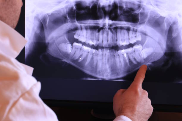 Best Urgent Tooth Repair  in Champion Heights, OH
